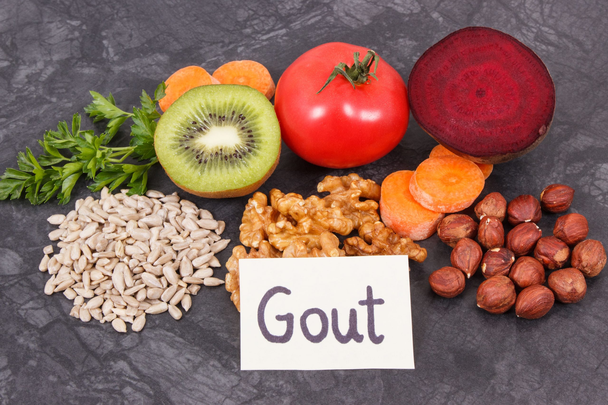 How to Avoid Gouty Arthritis?